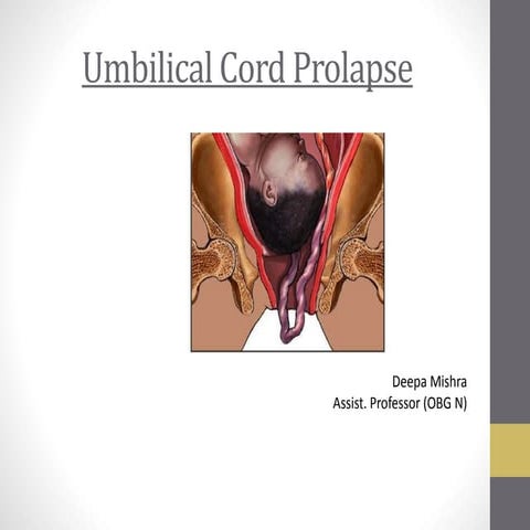 Umbilical Cord prolapse