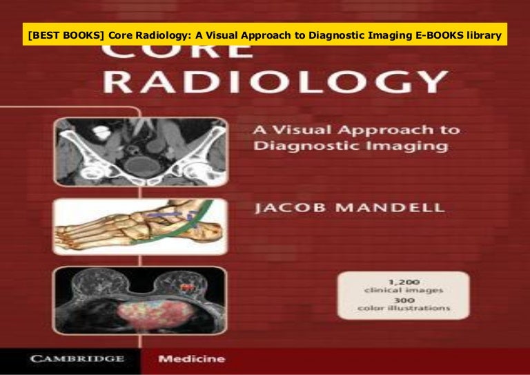 [BEST BOOKS] Core Radiology A Visual Approach to Diagnostic Imaging