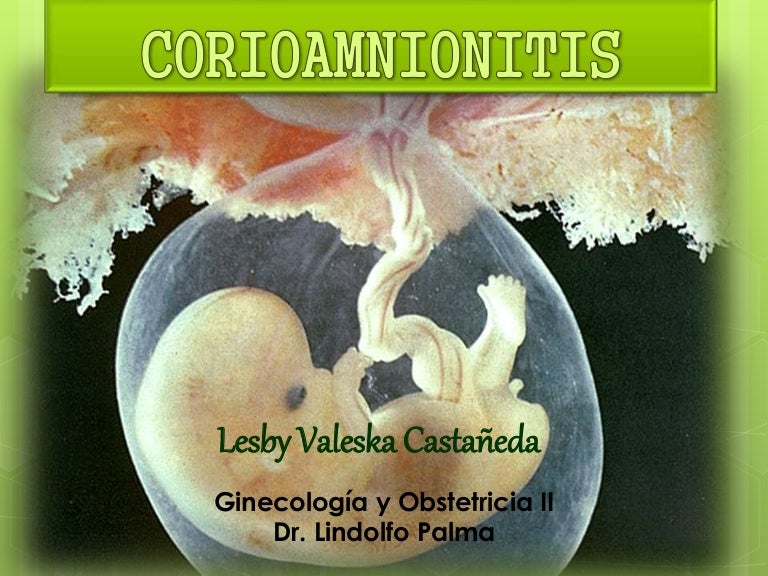 Corioamnionitis