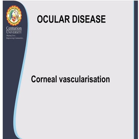 Corneal-vascularisation.pdf cornea disease