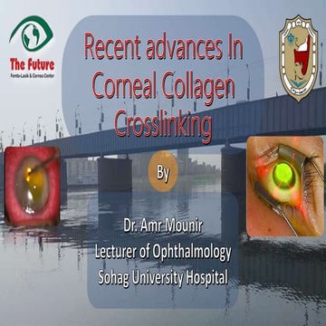 Corneal collagen crosslinking