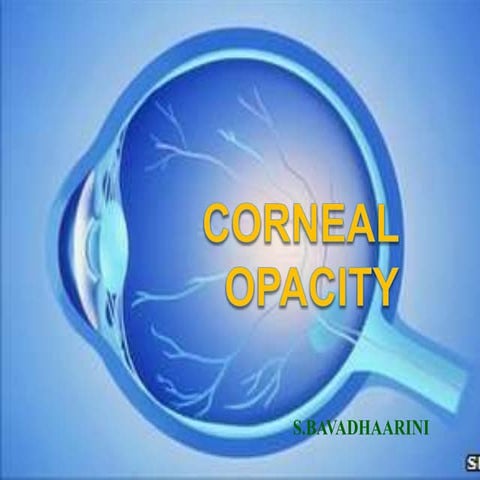 Corneal opacity