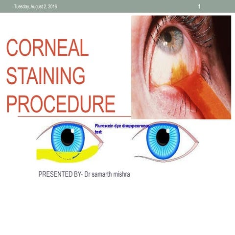 Corneal staining procedure