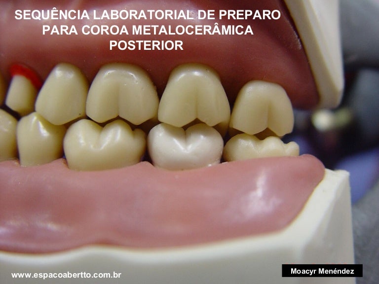 Como fazer um omelete saudavel e gostoso Preparo para coroa metaloceramica