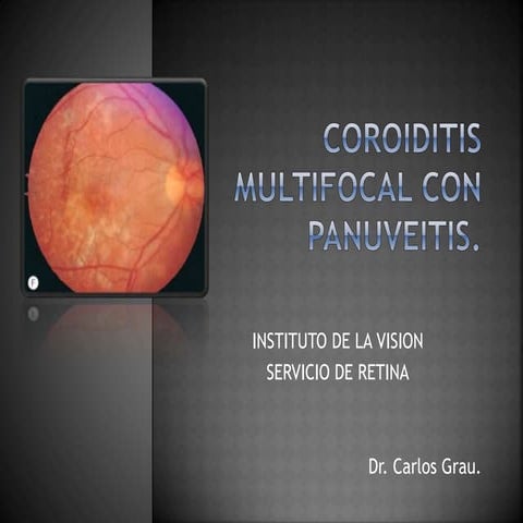 Coroiditis multifocal con_panuveitis | PPTX