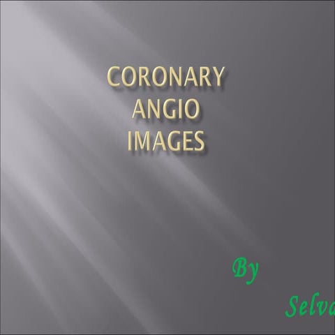 Coronary anatomy