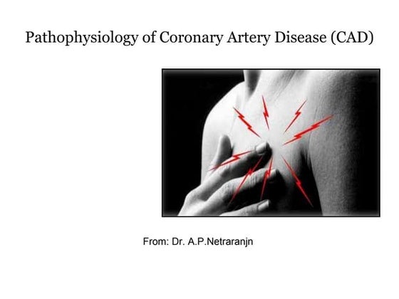 Coronary artery Disease | PPT
