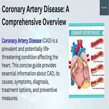 Coronary Artery Disease :A Comprehensive Overview | PPTX