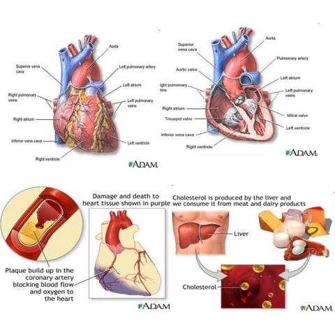 Coronary Heart Disease 
