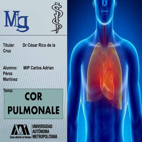 Cor pulmonale