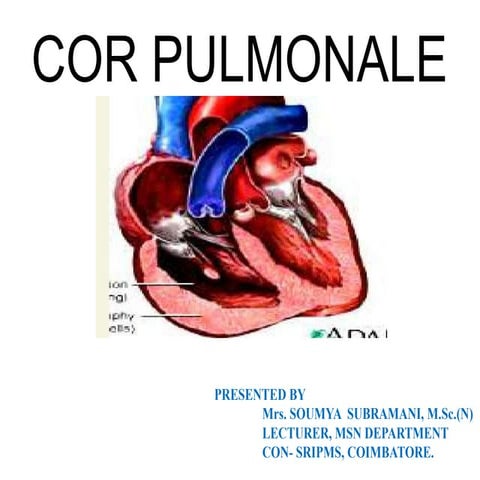 Corpulmonale