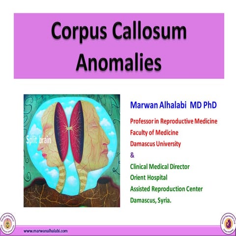 Corpus Callosum  Anomalies