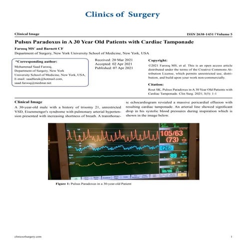 Pulsus Paradoxus in A 30 Year Old Patients with Cardiac Tamponade | PDF