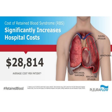 9. Cost of RBS Significantly Increases Hospital Costs $26,814 Avg ...