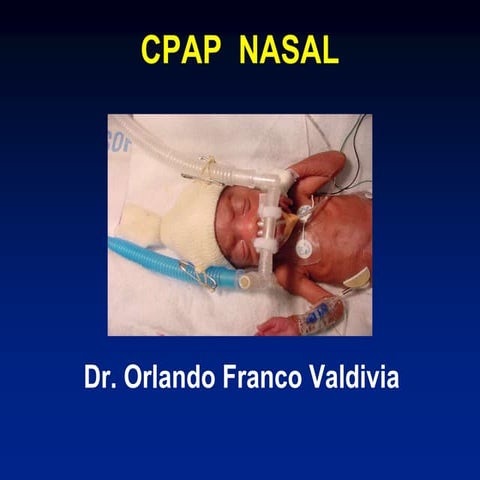 CPAP.ppt