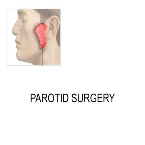Parotid surgery | PPTX
