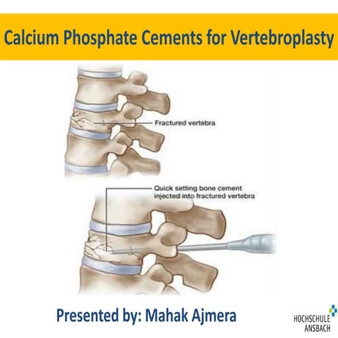 Cpc for vertebroplasty