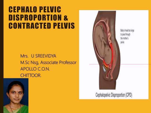 Subinvolution of the uterus | PPTX