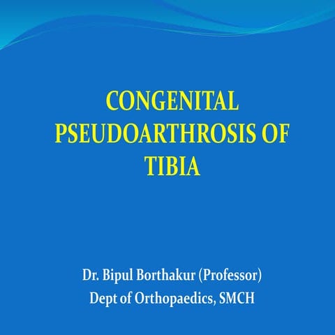 Congenital pseudoarthrosis of tibia