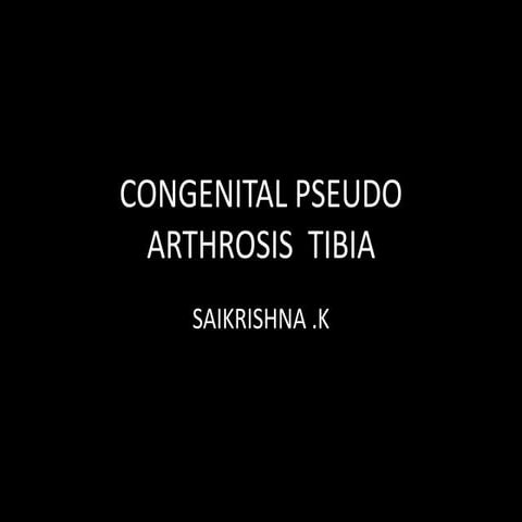 Congenital pseudoarthrosis tibia