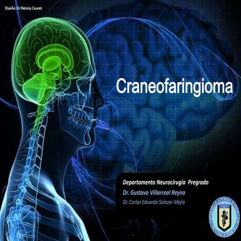 Craneofaringioma 2012
