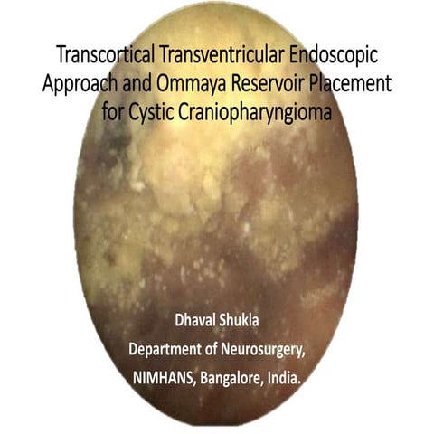 Craniopharyngioma endoscopy