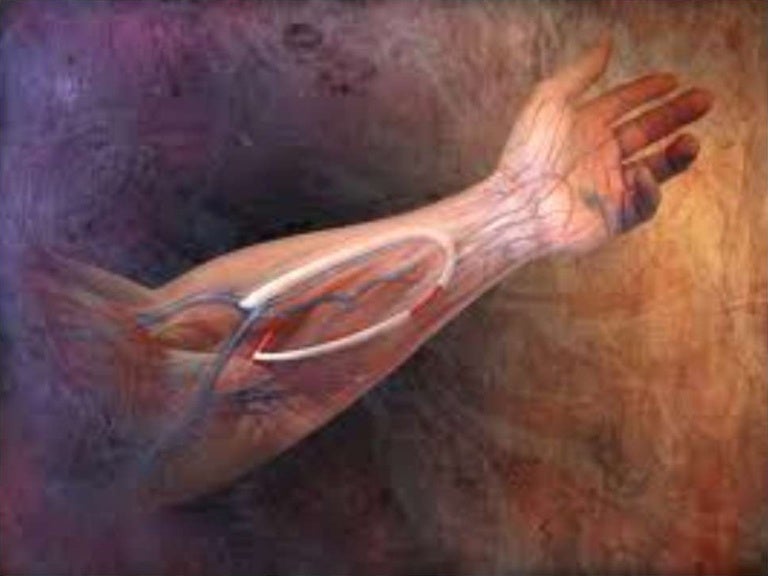 renal patients for vascular