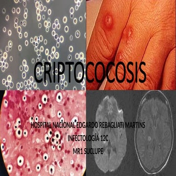 CRIPTOCOCOSIS FUNGEMIAS Y HONGOS E(1).pptx