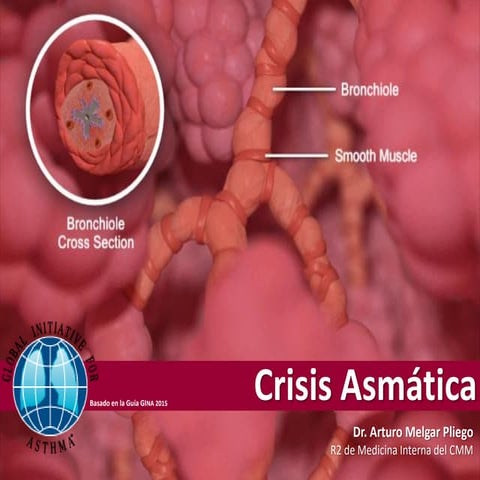 Crisis Asmatica