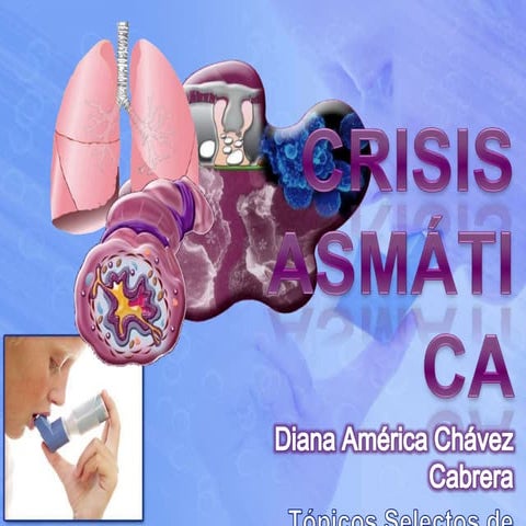 Crisis asmática y su manejo en urgencias