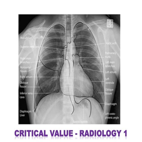 CRITICAL VALUE-RADIOLOGY for General Practitioner and Radiolog | PDF