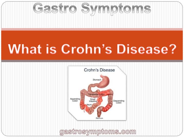 Crohn's Disease its causes with signs and symptoms | PPTX