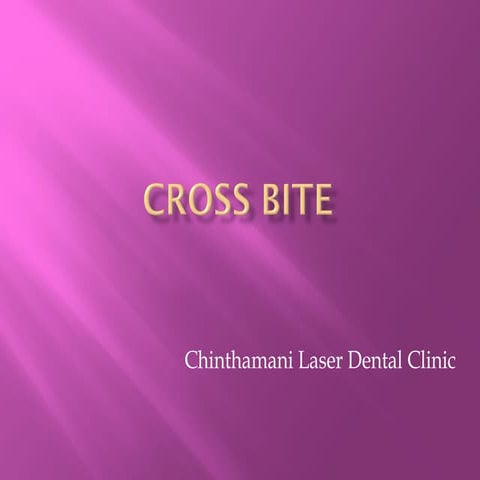 Malocclusion-Cross bite
