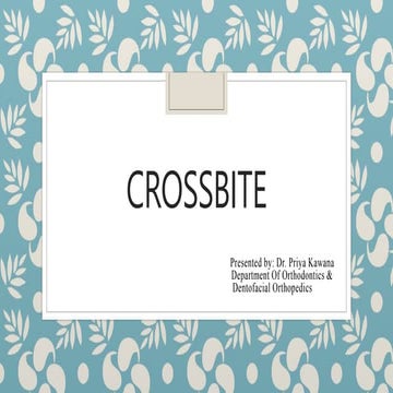 Crossbite is a form of malocclusion where a tooth (or teeth) has a more bucca...