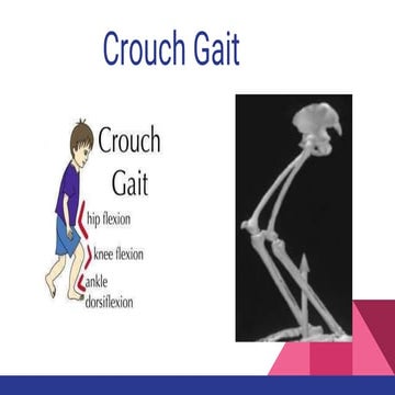 Crouch gait and its brief Medical And Physiotherapy Management 