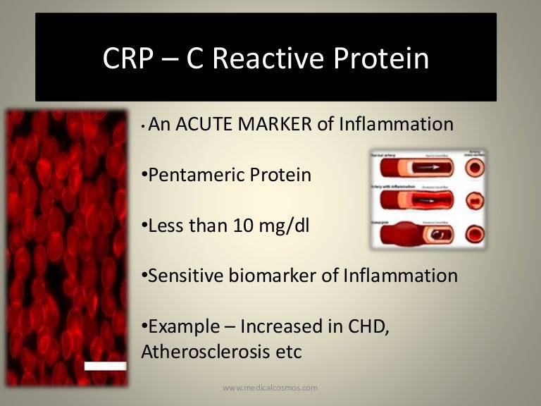 CRP C Reactive Protein Origin (Name) & Overview