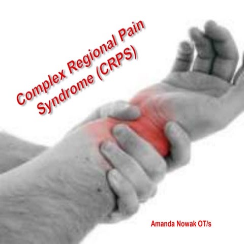 Trigger Finger - with glucocorticoid injection | PPTX