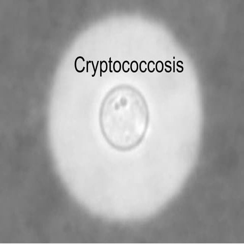 Cryptococcosis  neetu