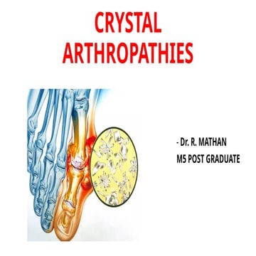 CRYSTAL ARTHROPATHIES.pptx crytal arthropathy