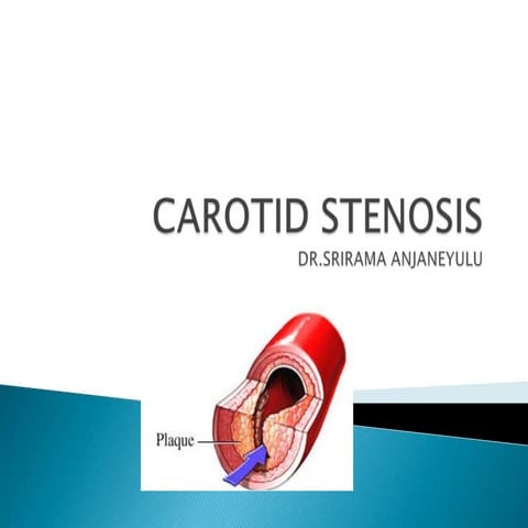 CAROTID ARTERY STENOSIS