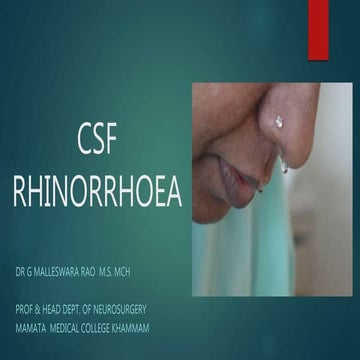 Csf Rhinorrhea - Overview