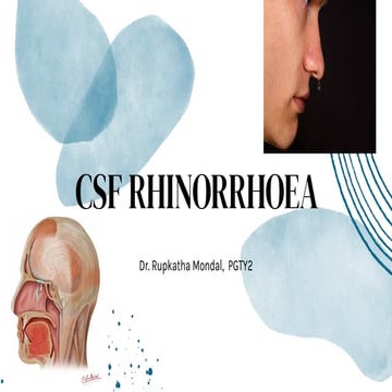 CSF rhinorrhea its cause management .pptx