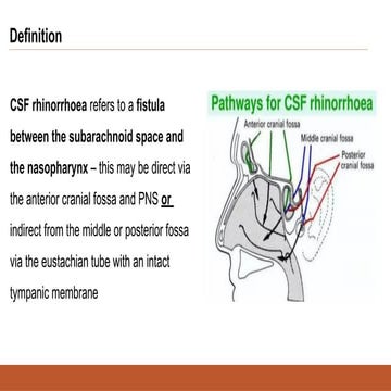 CSF RHINORRHOEA presentation resident year