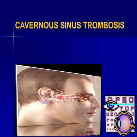 Cavernous sinus thrombosis