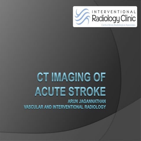 C T  Imaging Of Acute Stroke