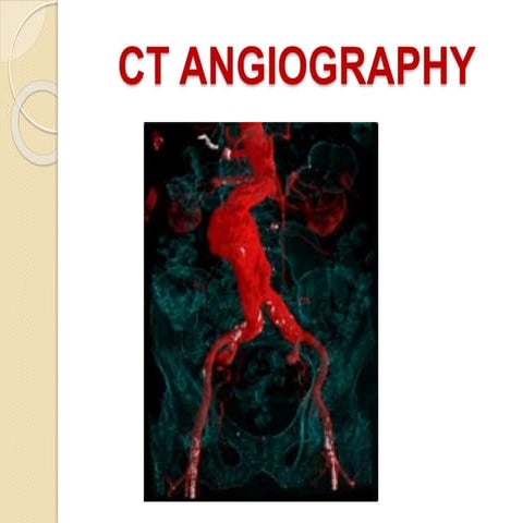 CT angiography