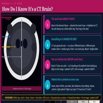 CT_Brain_How_to_Identify.pptxCT_Brain_How_to_Identify.pptx