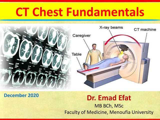 Ct chest fundamentals