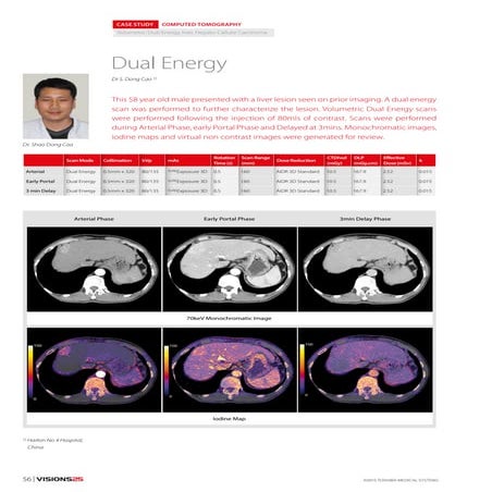 Dual energy case study