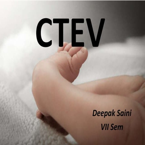 Congenital Talipes Equino Varus (CTEV)
